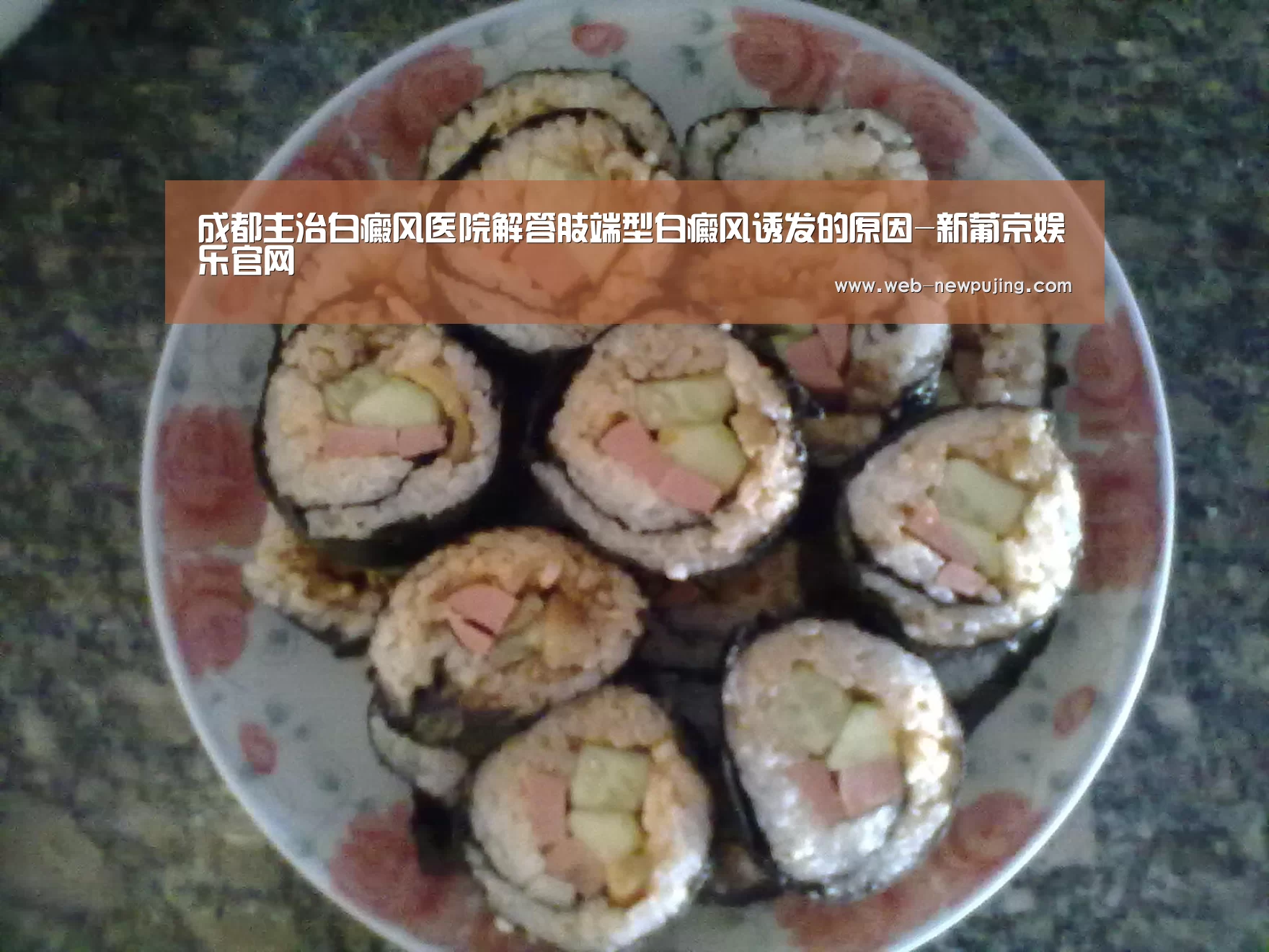 成都主治白癜风医院解答肢端型白癜风诱发的原因-新葡京娱乐官网